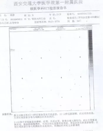 脾切除手术