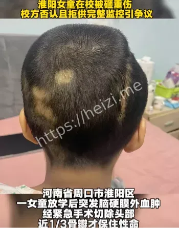 校园安全