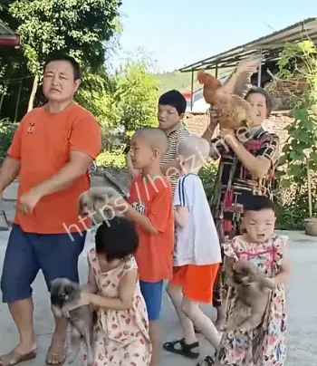 畸形孩子