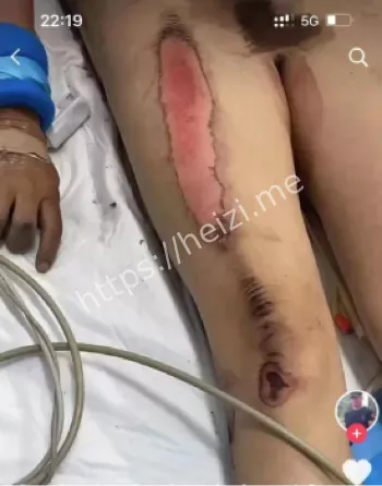 宝马酒醉女司机