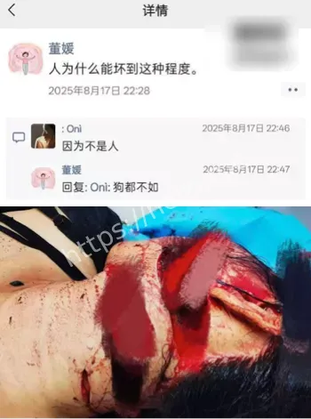 杨志宇车库怒杀